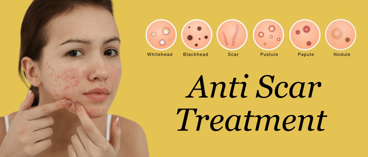 anti-scar-treatment